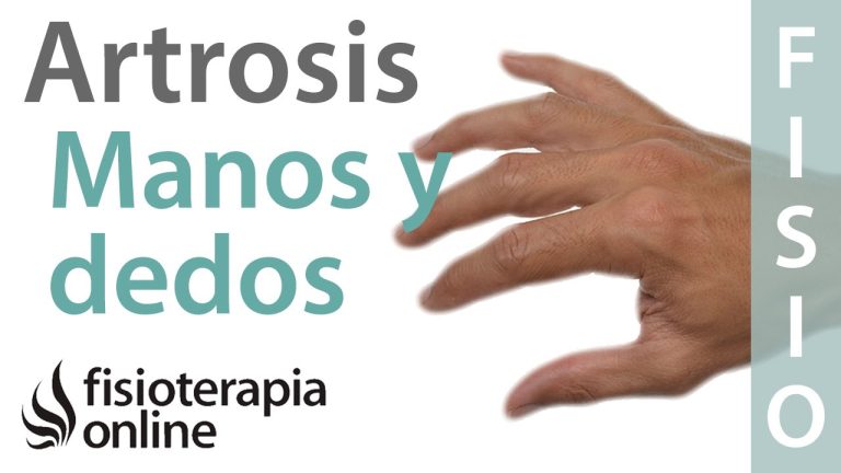 ¿Qué medicamento tomar para la artrosis de manos?